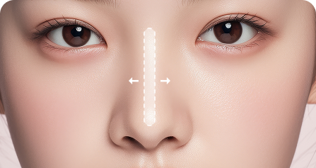 보형물이 움직이는 경우